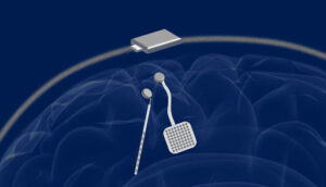 Scopri di più sull'articolo Tecnologie wireless applicate ai dispositivi medici