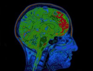Scopri di più sull'articolo Alimentazione sana associata a meno ferro nel cervello: migliorano facoltà cognitive negli anziani